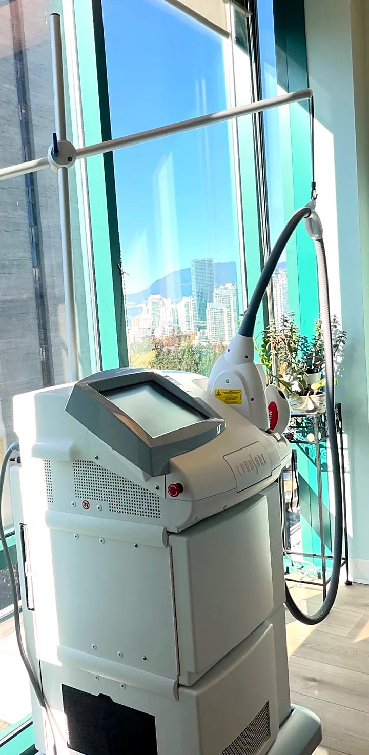 Cynosure Icon laser at Pure Light Laser Clinic, Vancouver