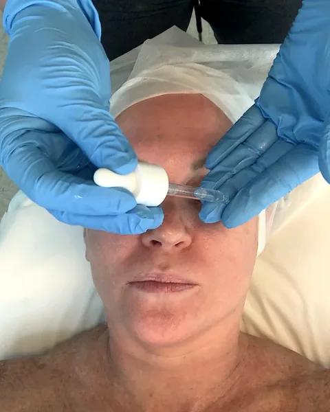 Serum applied with a dropper during a facial at Pure Light Laser