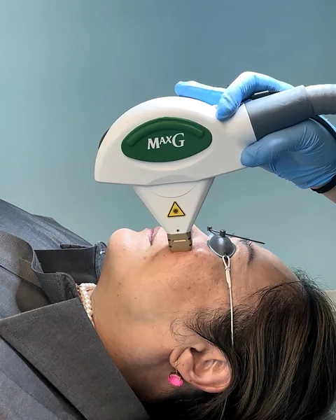 IPL photofacial with the MaxG handpiece at Pure Light Laser in Vancouver