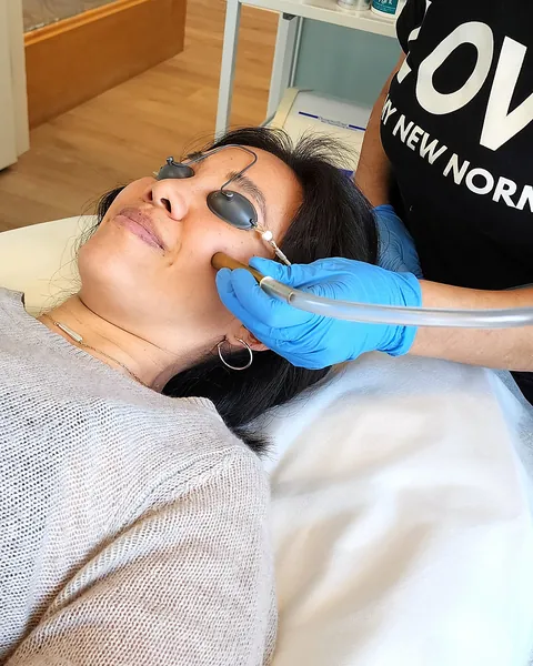 Diamond Peel microdermabrasion at Pure Light Laser in Vancouver