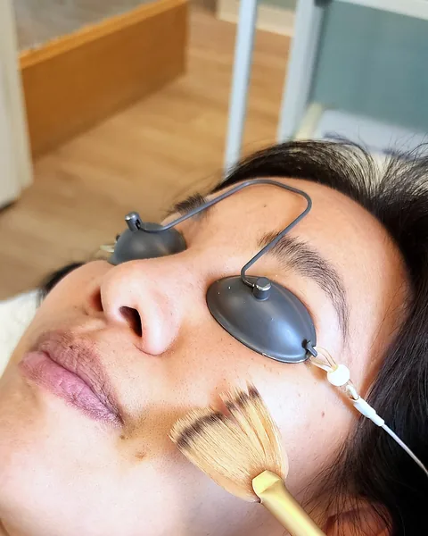 AHA peel applied with a fan brush at Pure Light Laser