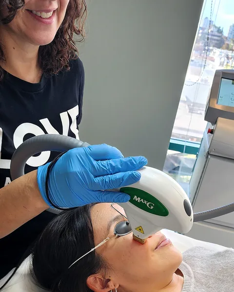 IPL photofacial for sun spot removal at Pure Light Laser in Vancouver