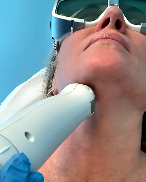 Laser wrinkle treatment along the jawline at Pure Light Laser in Vancouver