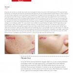 Desi Ink - Skin Rejuvenation Products