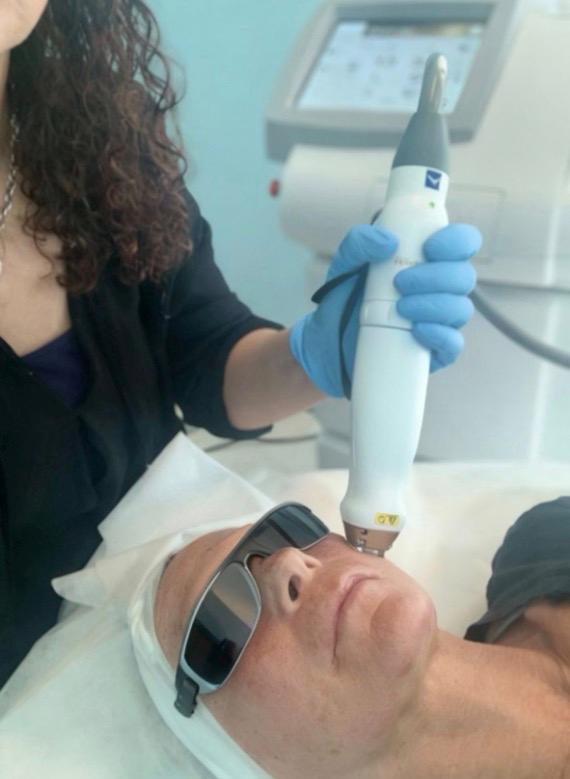 co2 fractional laser treatment