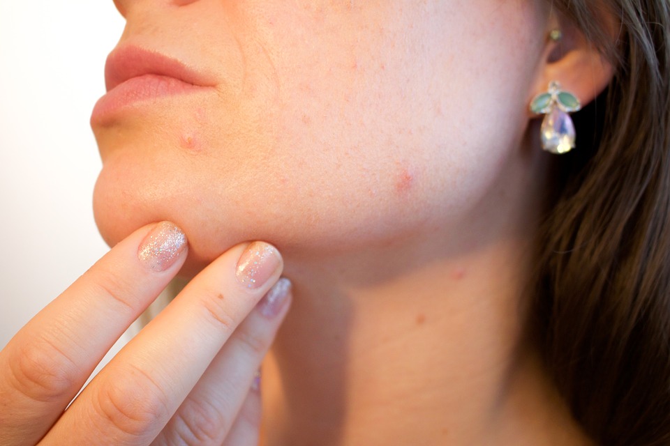 Microdermabrasion Facials Can Make Your Skin Glow