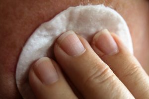 skin-care-laser