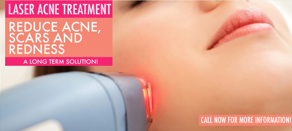 Laser Skin Treatment Vancouver